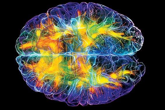 Dişi Beyin - Erkek Beyin